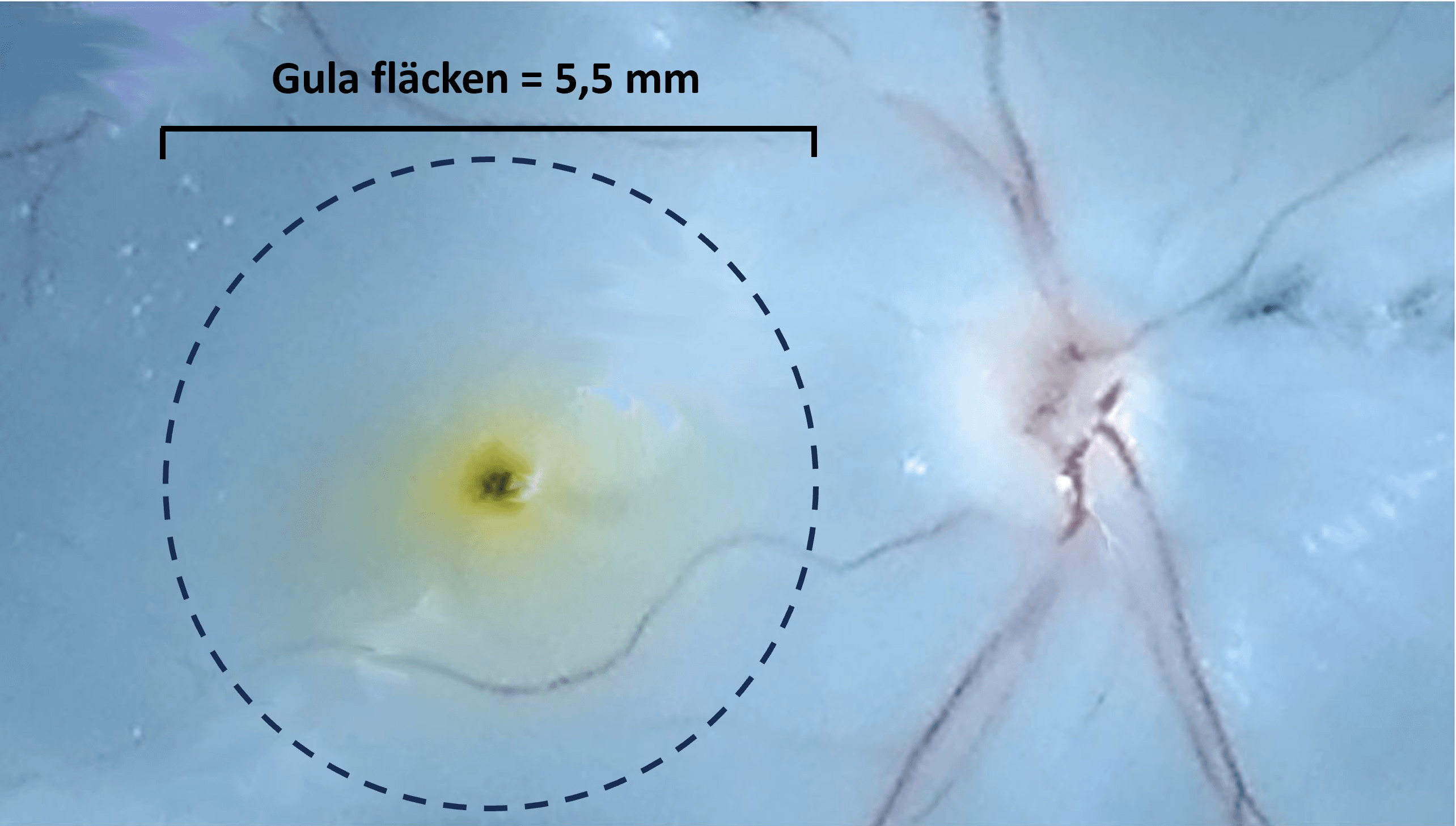 Närbild av näthinnan där gula fläcken (makula) är markerad med en streckad cirkel. Markeringen visar att gula fläcken är cirka 5,5 millimeter i diameter. Till höger syns synnervens utträde och näthinnans blodkärl.