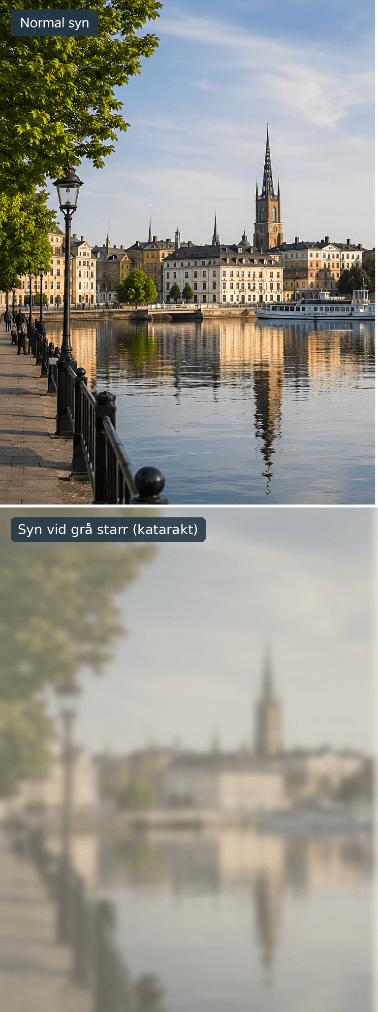 Två bilder av samma stadsmiljö, placerade ovanför varandra. Den övre visar normal syn med skarpa detaljer och tydliga färger. Den nedre illustrerar synen vid grå starr (katarakt), där bilden är suddig, disig och färgerna mer dämpade.